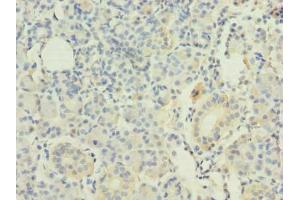 Immunohistochemistry of paraffin-embedded human pancreatic tissue using ABIN7167395 at dilution of 1:100 (RAP1A Antikörper  (AA 1-181))