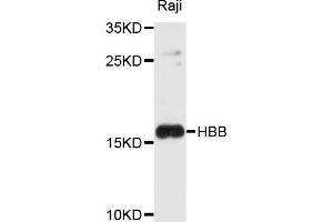 Western blot analysis of extracts of Raji cells, using HBB antibody (ABIN5997876) at 1/1000 dilution. (Hemoglobin Subunit beta Antikörper)