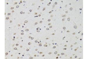 Immunohistochemistry of paraffin-embedded mouse brain using TMPO Antibody (ABIN5971365) at dilution of 1/100 (40x lens). (Thymopoietin Antikörper)
