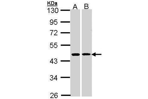 HSD3B2 抗体