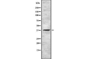 Western blot analysis GNRHR using HuvEc whole cell lysates (GNRHR Antikörper  (N-Term))