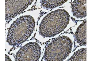 IHC analysis of MSY2/YBOX2/YBX2 using anti-MSY2/YBOX2/YBX2 antibody (ABIN7600636).