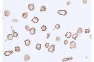 Immunocytochemistry (ICC) image for anti-Platelet Derived Growth Factor Receptor alpha (PDGFRA) (AA 24-525) antibody (ABIN7453341) (Rekombinanter PDGFRA Antikörper  (AA 24-525))