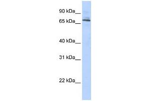 WB Suggested Anti-TRIM6 Antibody Titration:  0. (TRIM6 Antikörper  (Middle Region))