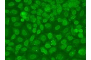 Immunofluorescence analysis of A549 cells using TARBP2 antibody. (TARBP2 Antikörper  (AA 1-366))
