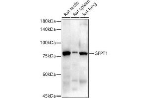 Western blot analysis of extracts of various cell lines, using GFPT1 antibody (ABIN7267430) at 1:1000 dilution. (GFPT1 Antikörper)