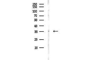 Western blot analysis of lysates from Rat lung, using CLN8 Antibody at 1/1000 dilution.