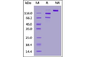 Human Complement C5, His Tag on  under reducing (R) and ing (NR) conditions.