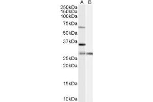 Image no. 1 for anti-Pre-mRNA Processing Factor 31 (PRPF31) (Internal Region) antibody (ABIN375228) (PRPF31 Antikörper  (Internal Region))