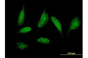 Immunofluorescence of purified MaxPab antibody to CHCHD3 on HeLa cell. (CHCHD3 Antikörper  (AA 1-227))