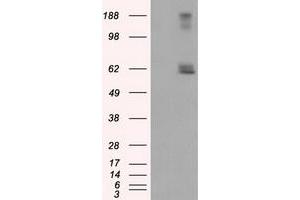 HEK293T cells were transfected with the pCMV6-ENTRY control (Left lane) or pCMV6-ENTRY LIPG (Right lane) cDNA for 48 hrs and lysed. (LIPG Antikörper)