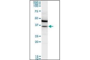 Western Blotting (WB) image for anti-Malate Dehydrogenase 2, NAD (Mitochondrial) (MDH2) antibody (ABIN953359) (MDH2 Antikörper)