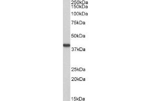 ABIN4902651 (0. (Hydroxyacid Oxidase 2 (HAO2) Antikörper)