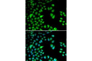 Immunofluorescence analysis of HeLa cells using RPS6KA3 antibody (ABIN5973157). (RPS6KA3 Antikörper)