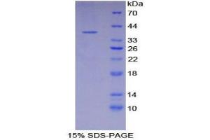 SDS-PAGE (SDS) image for Osteocalcin (BGLAP) (AA 21-99) protein (His tag,GST tag) (ABIN1879912)