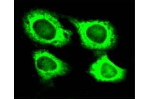 Immunofluorescence of HeLa cell line with WARS polyclonal antibody . (WARS Antikörper)