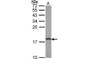 WB Image Sample (30 ug of whole cell lysate) A: Hep G2 , 12% SDS PAGE antibody diluted at 1:1000 (PFDN5 Antikörper)