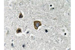 Immunohistochemistry analyzes of BNIP-3 antibody in paraffin-embedded human brain tissue. (BNIP3 Antikörper)