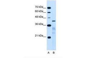 Image no. 2 for anti-MARVEL Domain Containing 3 (MARVELD3) (AA 219-268) antibody (ABIN6739457) (MARVELD3 Antikörper  (AA 219-268))