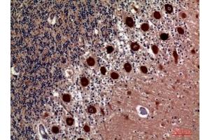 anti-Hydroxysteroid (11-Beta) Dehydrogenase 1 (HSD11B1) (N-Term) antibody