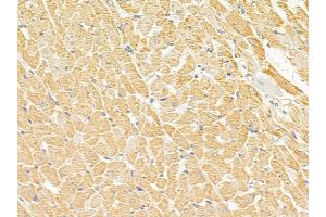 PDGF Receptor beta Mouse Monoclonal Antibody at 1/100 staining rat heart tissue by IHC-P.