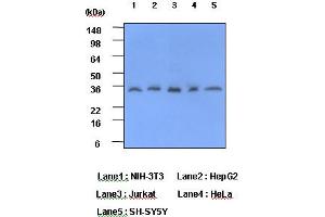 Western Blotting (WB) image for anti-C-Reactive Protein (CRP) antibody (ABIN361037) (CRP Antikörper)