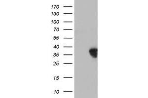 Western Blotting (WB) image for anti-Homeobox C11 (HOXC11) (AA 1-304) antibody (ABIN1490737) (HOXC11 Antikörper  (AA 1-304))