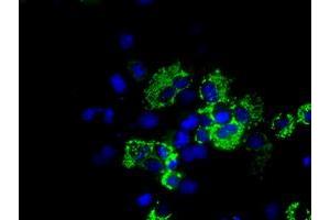 Anti-ACO2 mouse monoclonal antibody (ABIN2452697) immunofluorescent staining of COS7 cells transiently transfected by pCMV6-ENTRY ACO2 (RC204307). (ACO2 Antikörper)