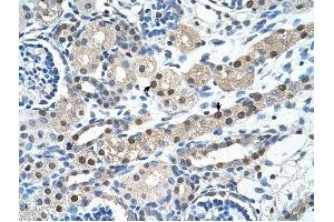 IGSF1 antibody was used for immunohistochemistry at a concentration of 4-8 ug/ml to stain Epithelial cells of renal tubule (arrows) in Human Kidney. (IGSF1 Antikörper  (N-Term))