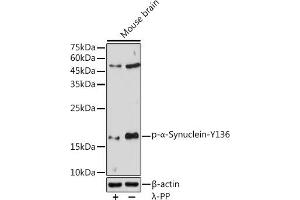 Western blot analysis of extracts of Mouse brain, using Phospho-α-Synuclein-Y136 antibody (ABIN3019943, ABIN3019944, ABIN3019945, ABIN1682064 and ABIN1682065) at 1:1000 dilution. (SNCA Antikörper  (pTyr136))