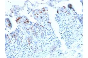 Formalin-fixed, paraffin-embedded human Small Intestine stained with CD209 Recombinant Rabbit Monoclonal Antibody (C209/2749R). (Rekombinanter DC-SIGN/CD209 Antikörper)