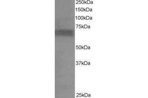 Western Blotting (WB) image for anti-Ribosomal Protein S6 Kinase, 70kDa, Polypeptide 1 (RPS6KB1) (C-Term) antibody (ABIN2465296) (RPS6KB1 Antikörper  (C-Term))