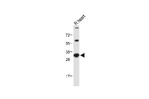 Western Blotting (WB) image for anti-Caspase 3 (CASP3) (AA 149-179), (Asp175) antibody (ABIN651176)