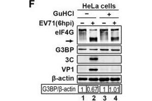 EV71 infection blocks tSG formation independent of 3C. (beta Actin Antikörper)