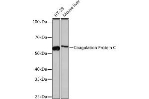 Western blot analysis of extracts of various cell lines, using Coagulation Coagulation Protein C Rabbit mAb (ABIN7271333) at 1:1000 dilution. (PROC Antikörper)