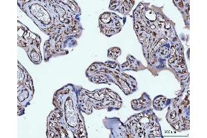 IHC analysis of Vimentin using anti-Vimentin antibody (ABIN3042344).