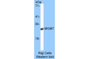Image no. 1 for anti-O6-Methylguanine-DNA-Methyltransferase (MGMT) (AA 8-221) antibody (ABIN6560107) (MGMT Antikörper  (AA 8-221))