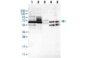 Western blot analysis of Lane 1: RT-4, Lane 2: U-251 MG, Lane 3: Human Plasma, Lane 4: Liver, Lane 5: Tonsil with MUM1L1 polyclonal antibody .