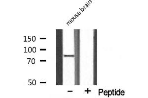 Western blot analysis on mouse brain lysate using ES8L2 Antibody. (EPS8-Like 2 Antikörper  (N-Term))