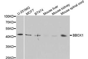 Western blot analysis of extracts of various cell lines, using BBOX1 antibody (ABIN5973426) at 1/1000 dilution.