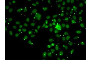 Immunofluorescence analysis of A549 cell using ATRIP antibody. (ATRIP Antikörper)