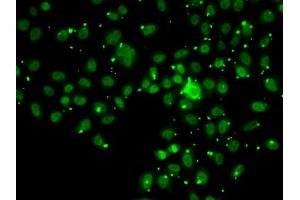 Immunofluorescence analysis of A549 cell using ATRIP antibody.