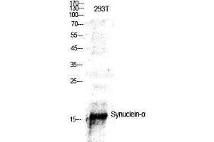 Western Blotting (WB) image for anti-Synuclein, alpha (SNCA) (Tyr1112) antibody (ABIN3177574) (SNCA Antikörper  (Tyr1112))