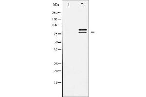 Western blot analysis of HSL expression in CalyculinA treated HeLa whole cell lysates,The lane on the left is treated with the antigen-specific peptide. (LIPE Antikörper  (Internal Region))