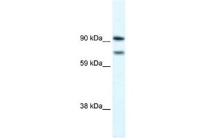 WB Suggested Anti-ZFHX1B Antibody Titration: 0. (ZEB2 Antikörper  (N-Term))