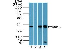 Image no. 2 for anti-Nucleoporin 35kDa (NUP35) (AA 280-330) antibody (ABIN960296) (NUP35 Antikörper  (AA 280-330))