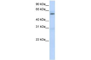 PRMT3 antibody used at 1 ug/ml to detect target protein. (PRMT3 Antikörper  (Middle Region))