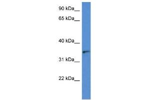 WB Suggested Anti-SORD AntibodyTitration: 1. (SORD Antikörper  (N-Term))