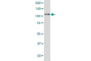 PTK2B monoclonal antibody (M02A), clone 3G2 Western Blot analysis of PTK2B expression in K-562 (  ). (PTK2B Antikörper  (AA 682-871))