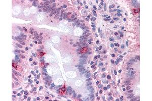 Anti-SEMA4B antibody IHC of human small intestine. (SEMA4B Antikörper  (Internal Region))
